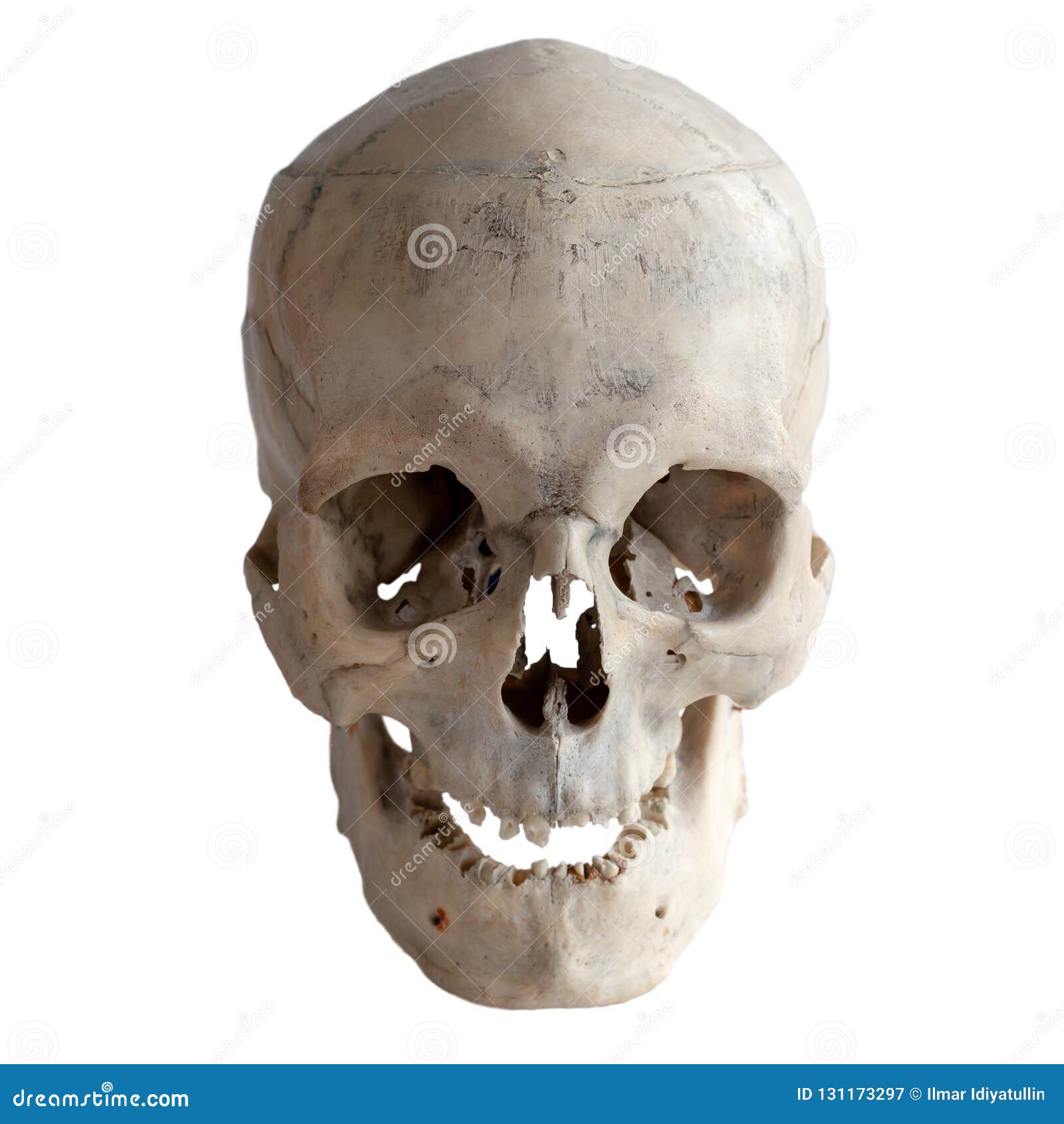 Vrai Crâne Humain Anatomique, Plan Rapproché Front View Image stock - Image  du personne, science: 131173297