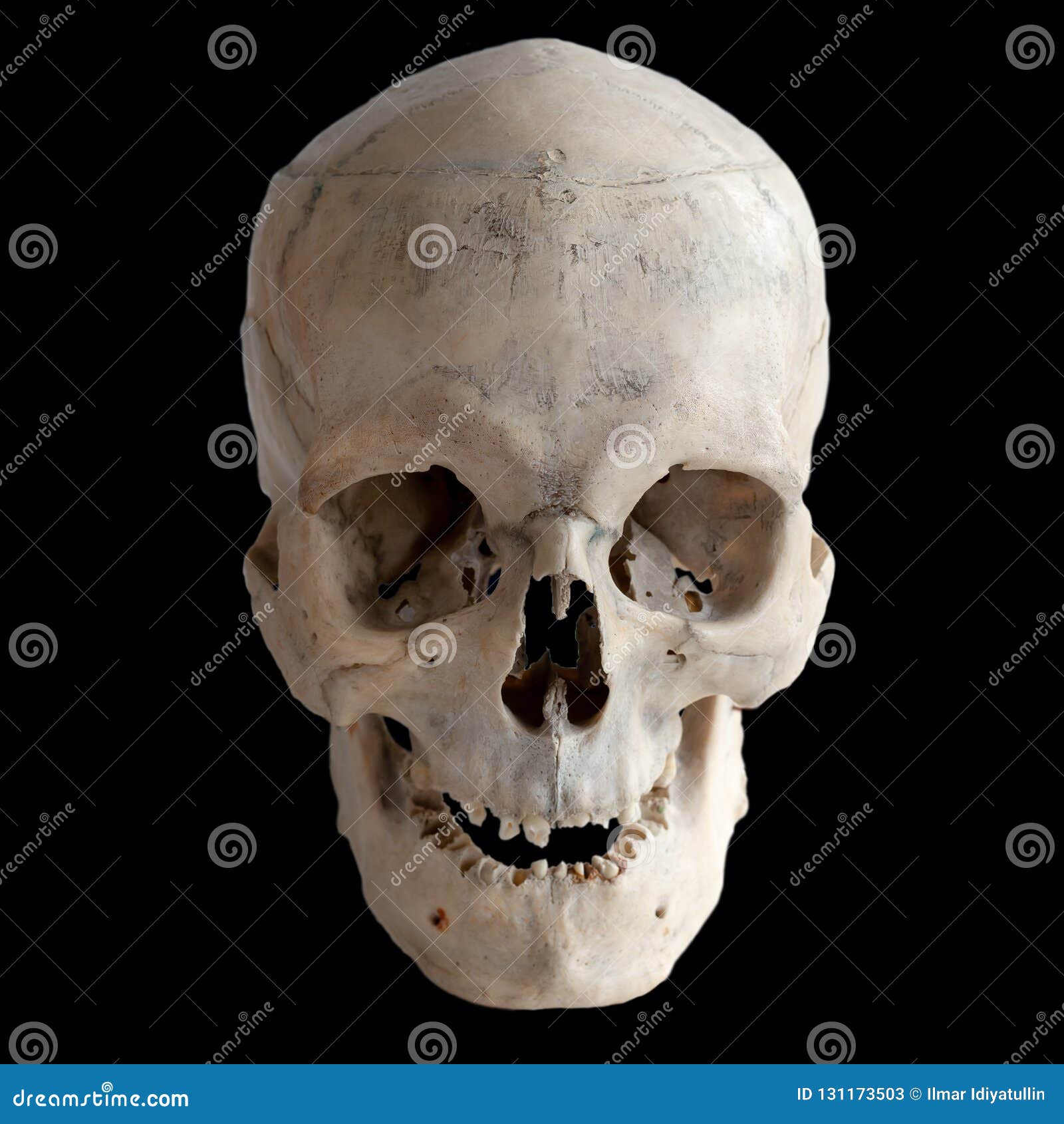 Vrai Crâne Humain Anatomique, Plan Rapproché Front View Image stock - Image  du squelette, crâne: 131173503
