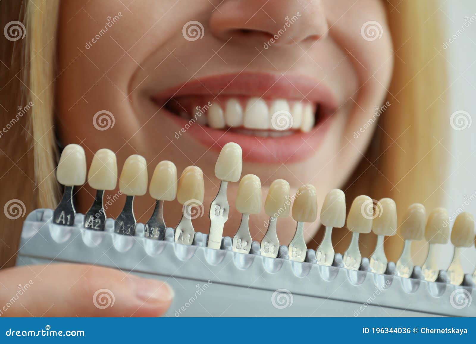 Die Tanden Aanpast Kleur Met Paletcloseup. Cosmetische Tandheelkunde Stock Foto - Image of licht, kleur: 196344036