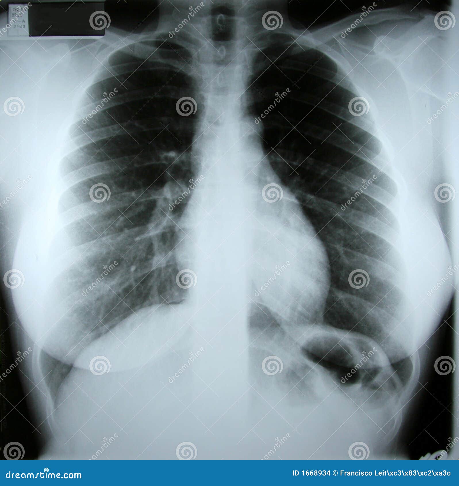 Vrouwelijke toraxröntgenstraal met ruimte om gegevens in te gaan