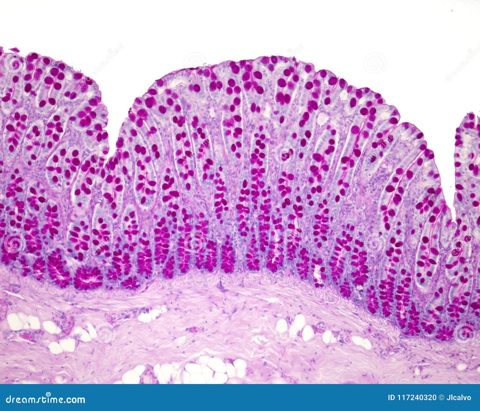 colon mucosa. goblet cells