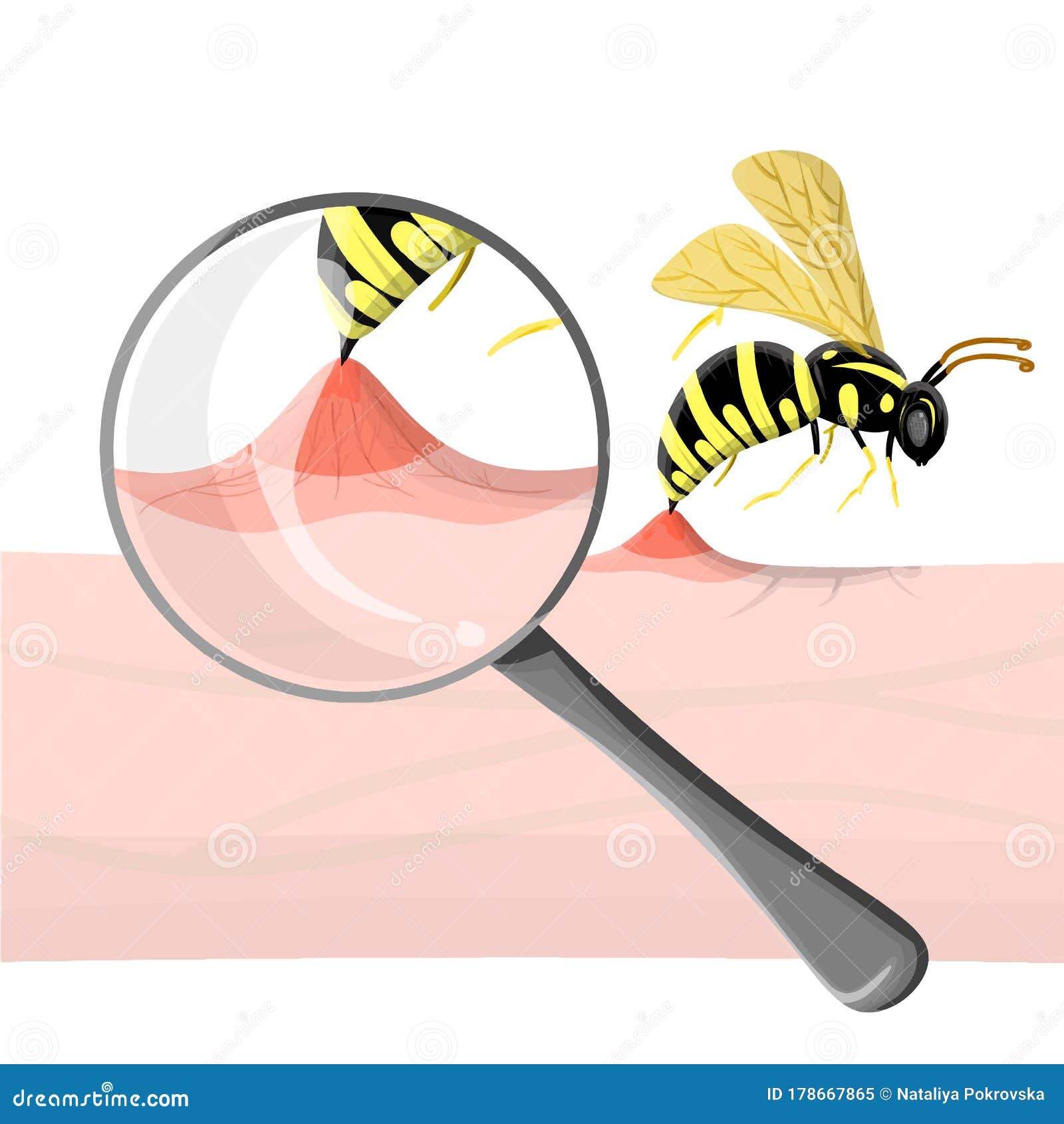 bee sting clipart