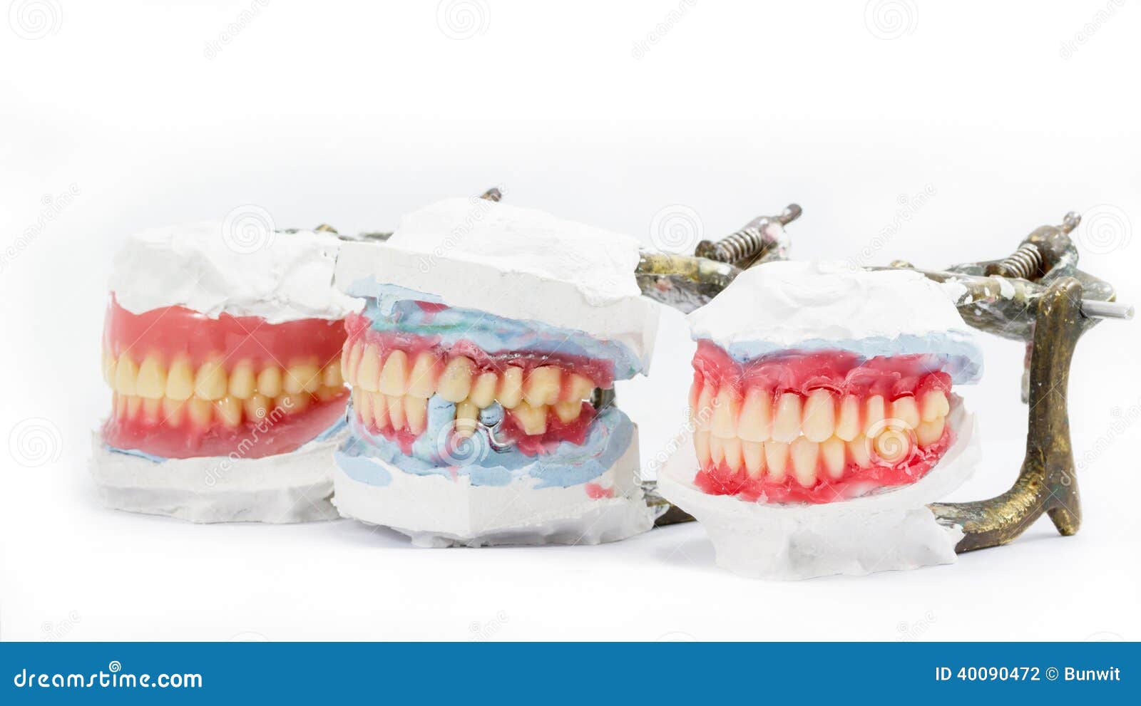 Wax Denture,dental Models Showing Different Types Stock Photo Image