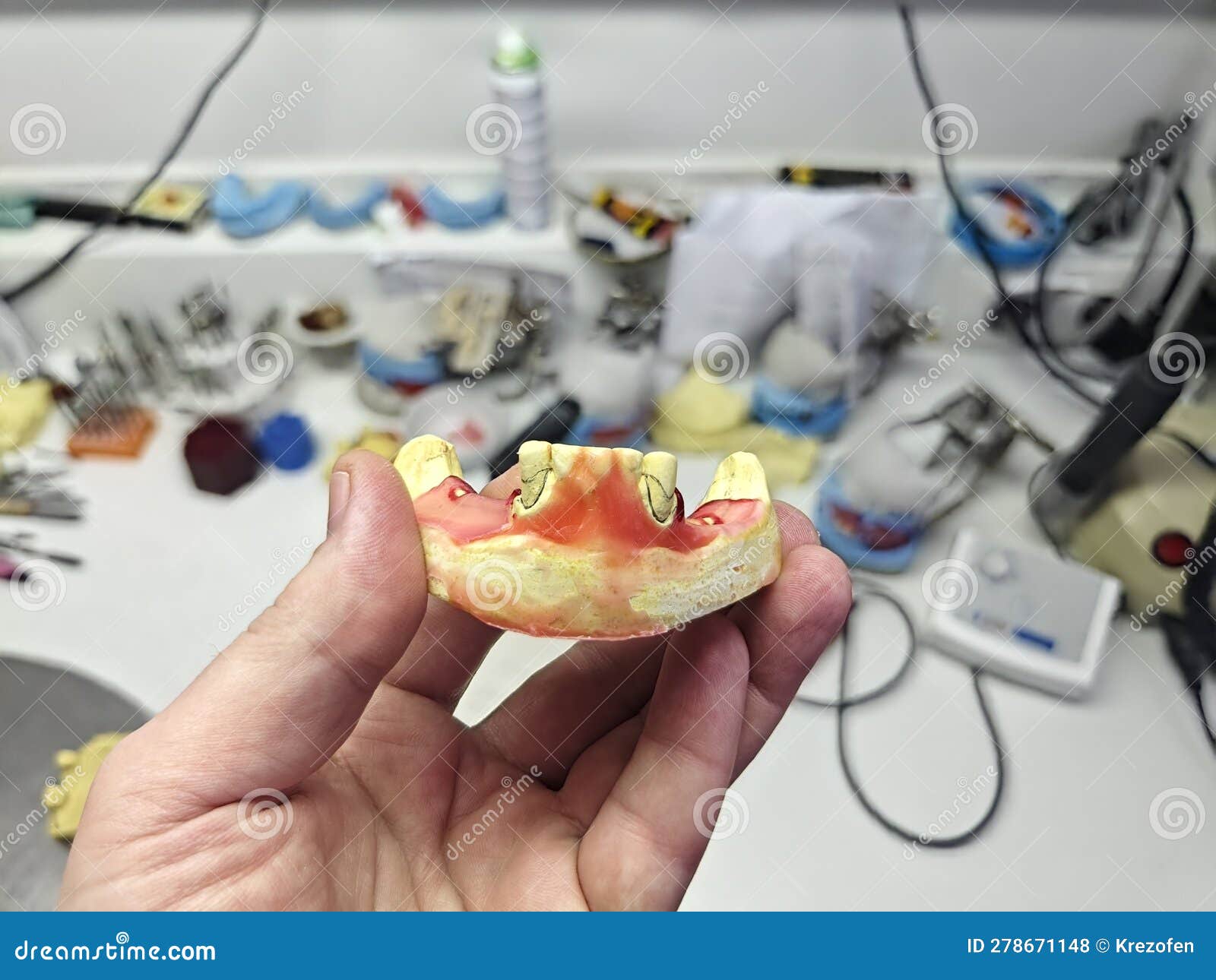 Wax dentures model stock photo. Image of professional 278671148