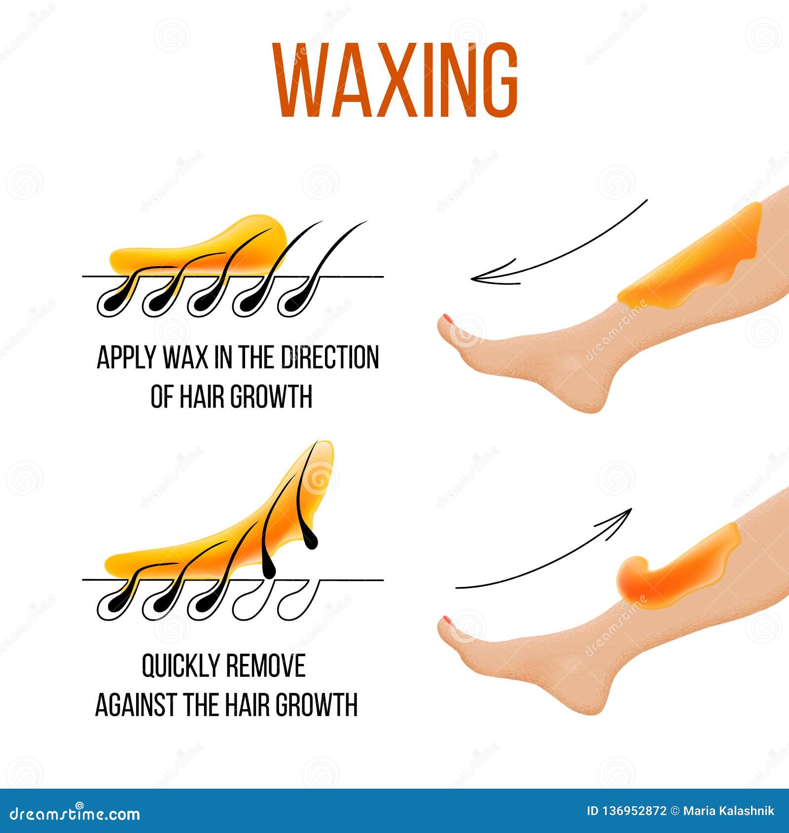 Waxing. Hair Removal. Smooth Clear Skin. Epilation and Depilation of Hair  Stock Vector - Illustration of intimate, massage: 136952872