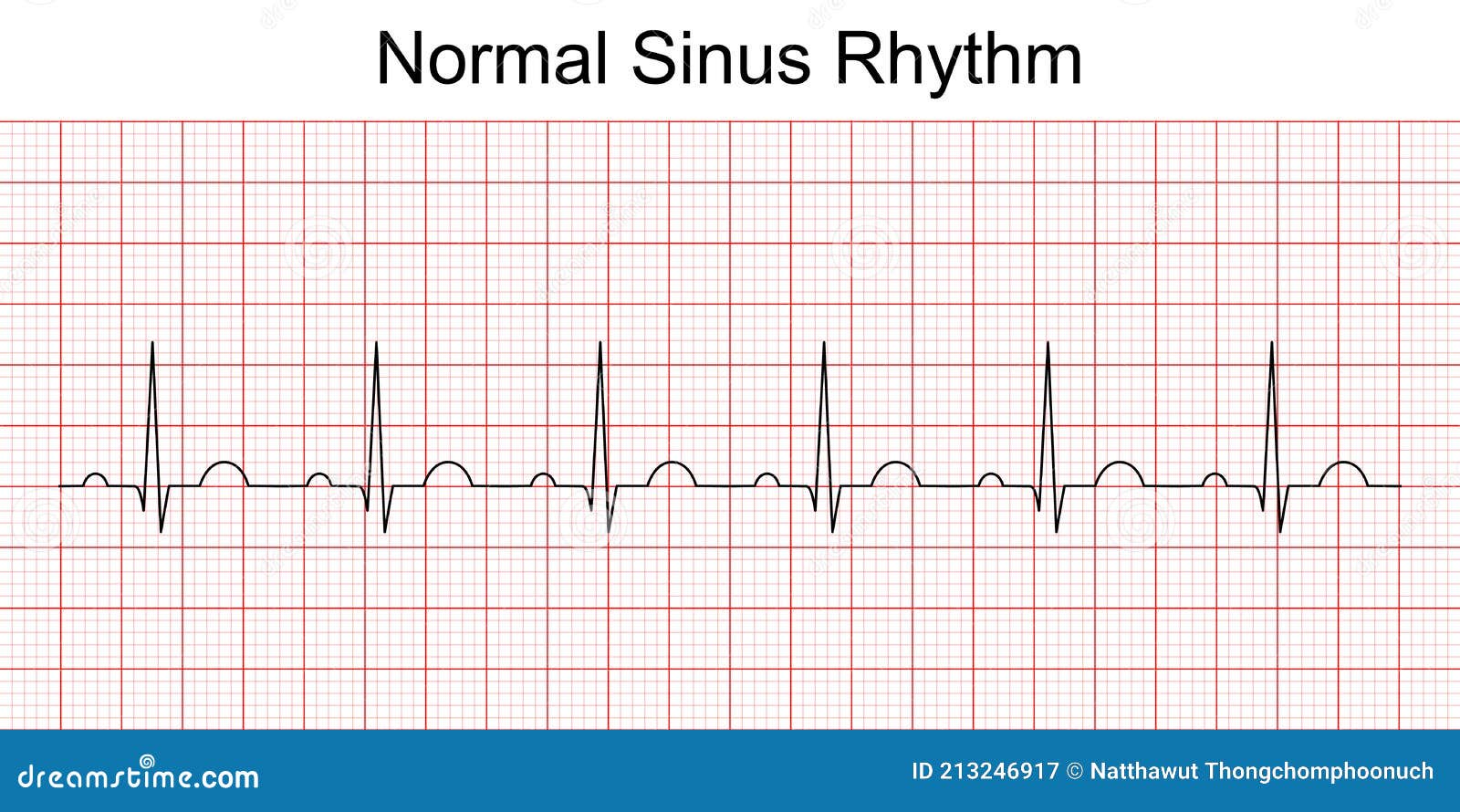 normal heartbeat sound normal heartbeat sound