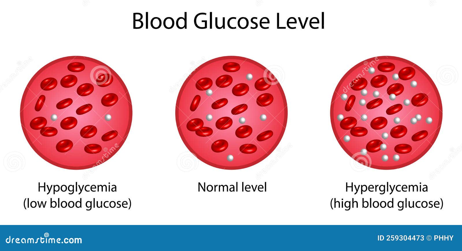 blood glucose levels. normal level, hyperglycemia , hypoglycemia, sugar test.  diagram