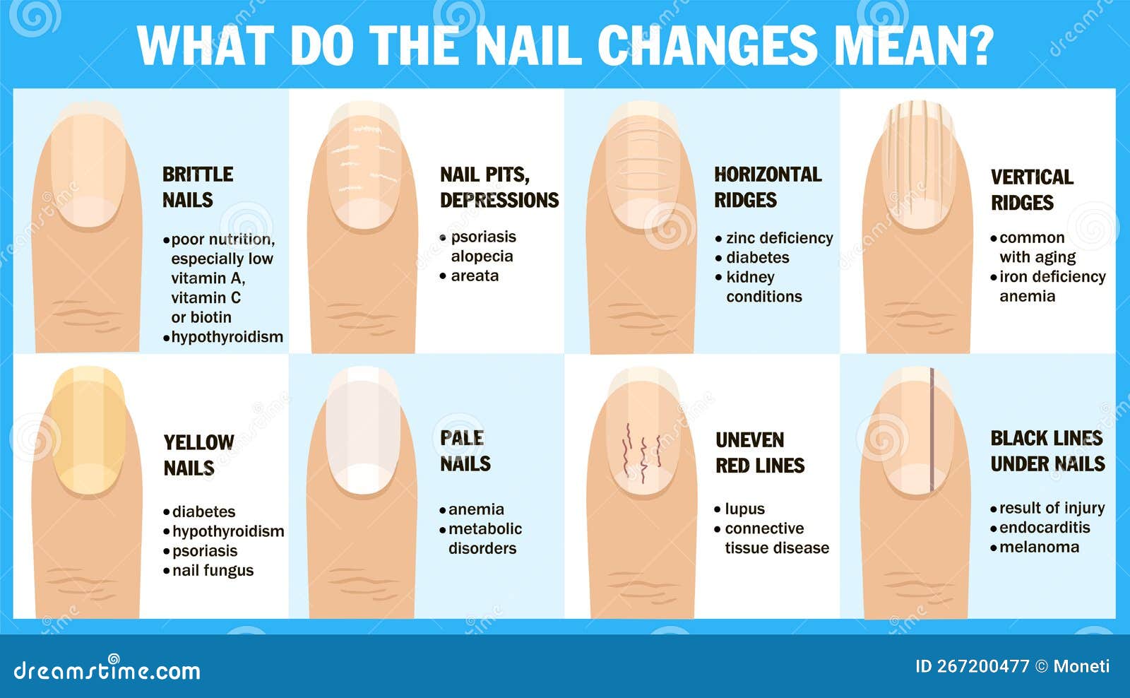 Nail repair: How to treat damaged nails