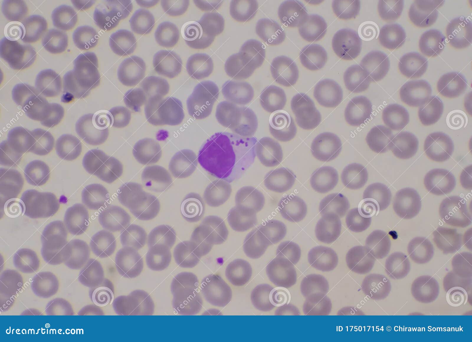 White Blood Cell Lymphocyte On Red Blood Cells Background Stock