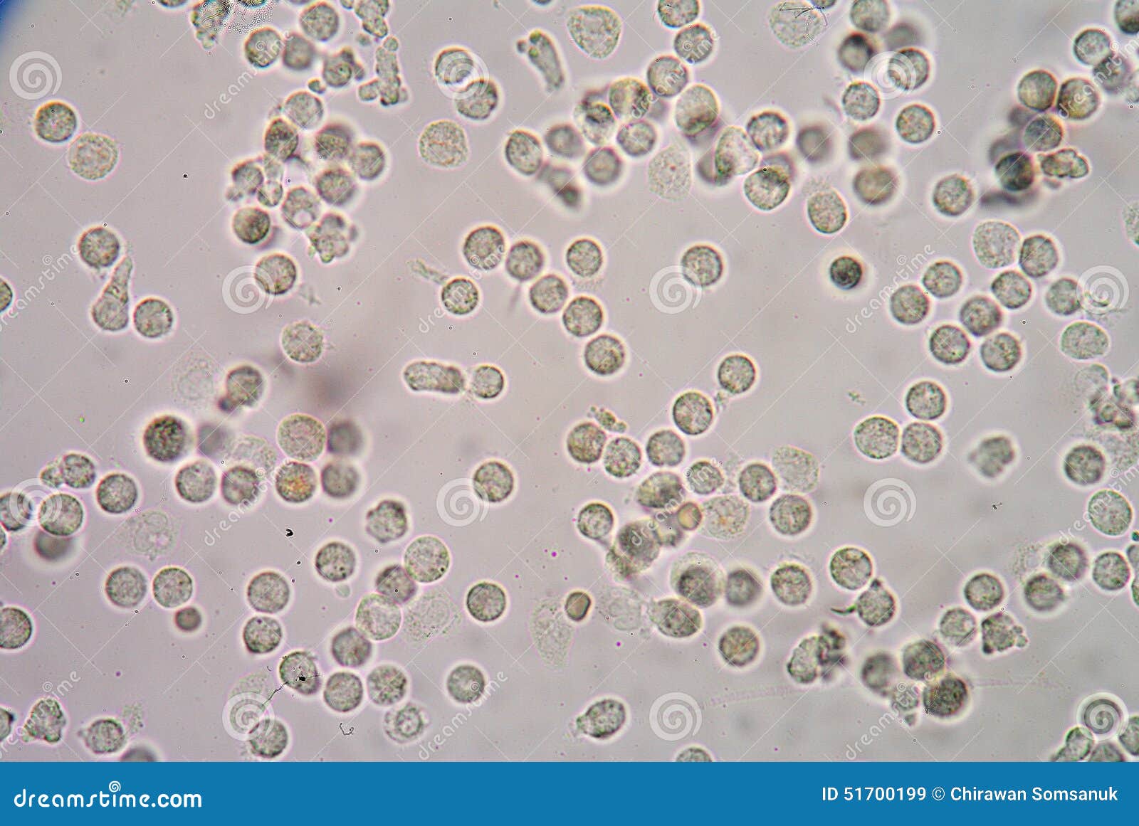 лейкоцитов нет но слизь в сперме фото 24