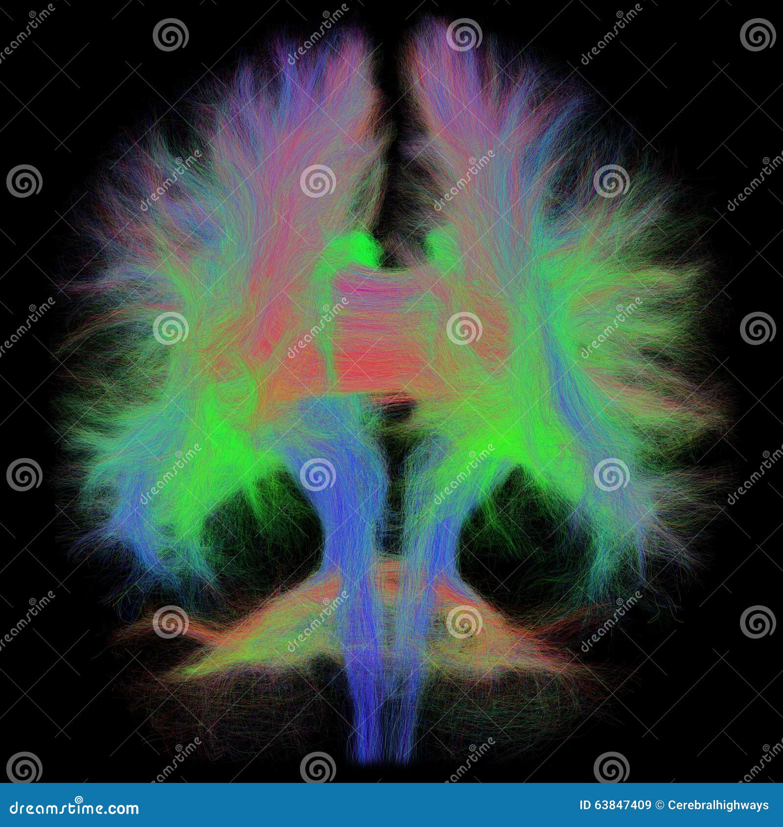 white matter tractography of the human brain in coronal view