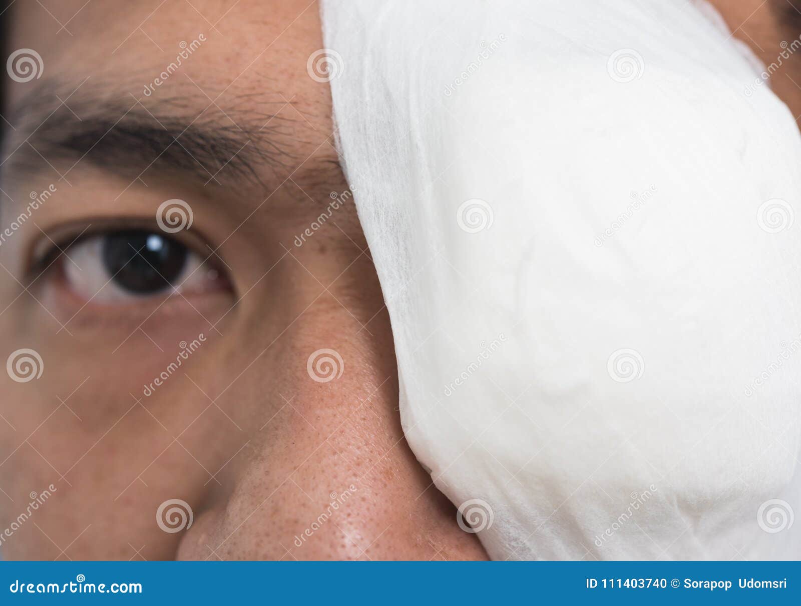 White Medicine Plaster Patch on the Eye Stock Photo Image of adult