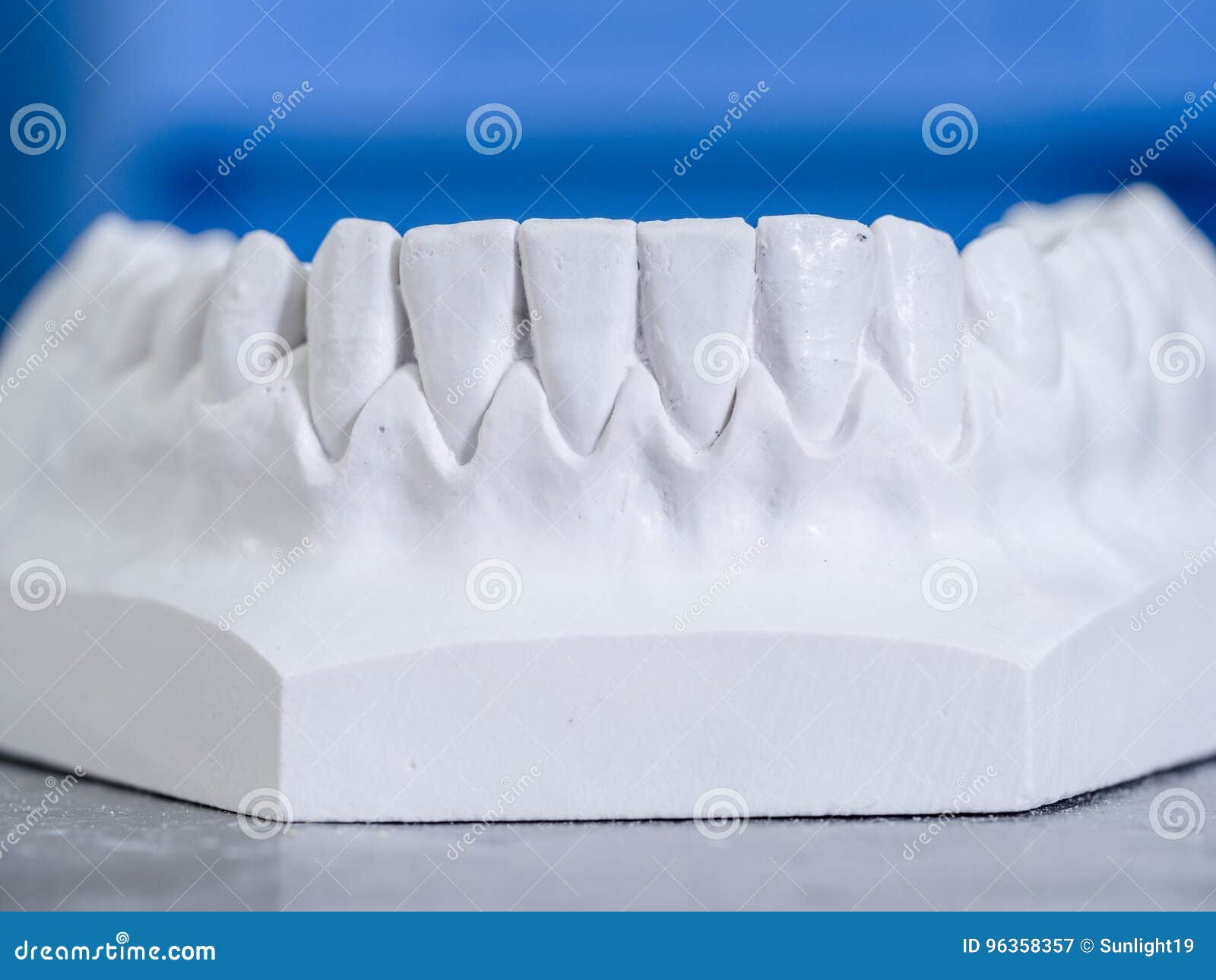 White Mold Dental of Plaster Stock Image Image of prosthesis, endodontics 96358357