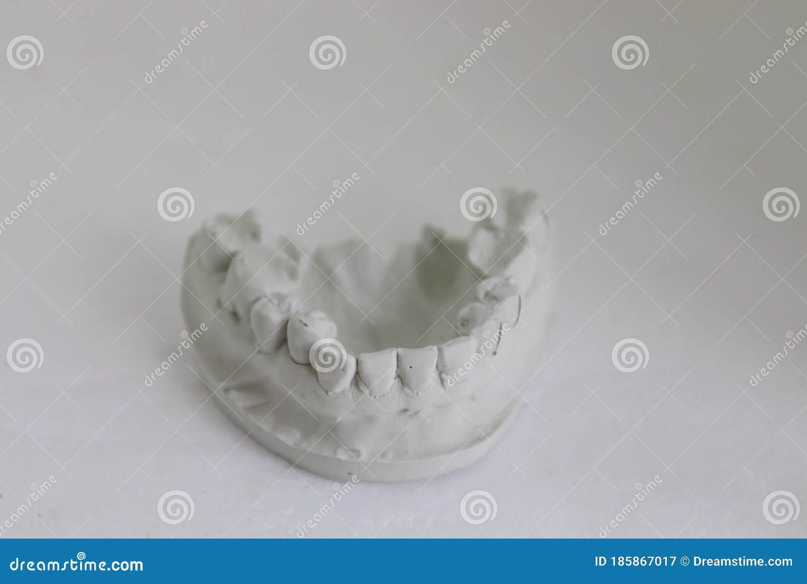 Plaster Impression Of Teeth. Dental Plaster Mold. Dental Mold Showing