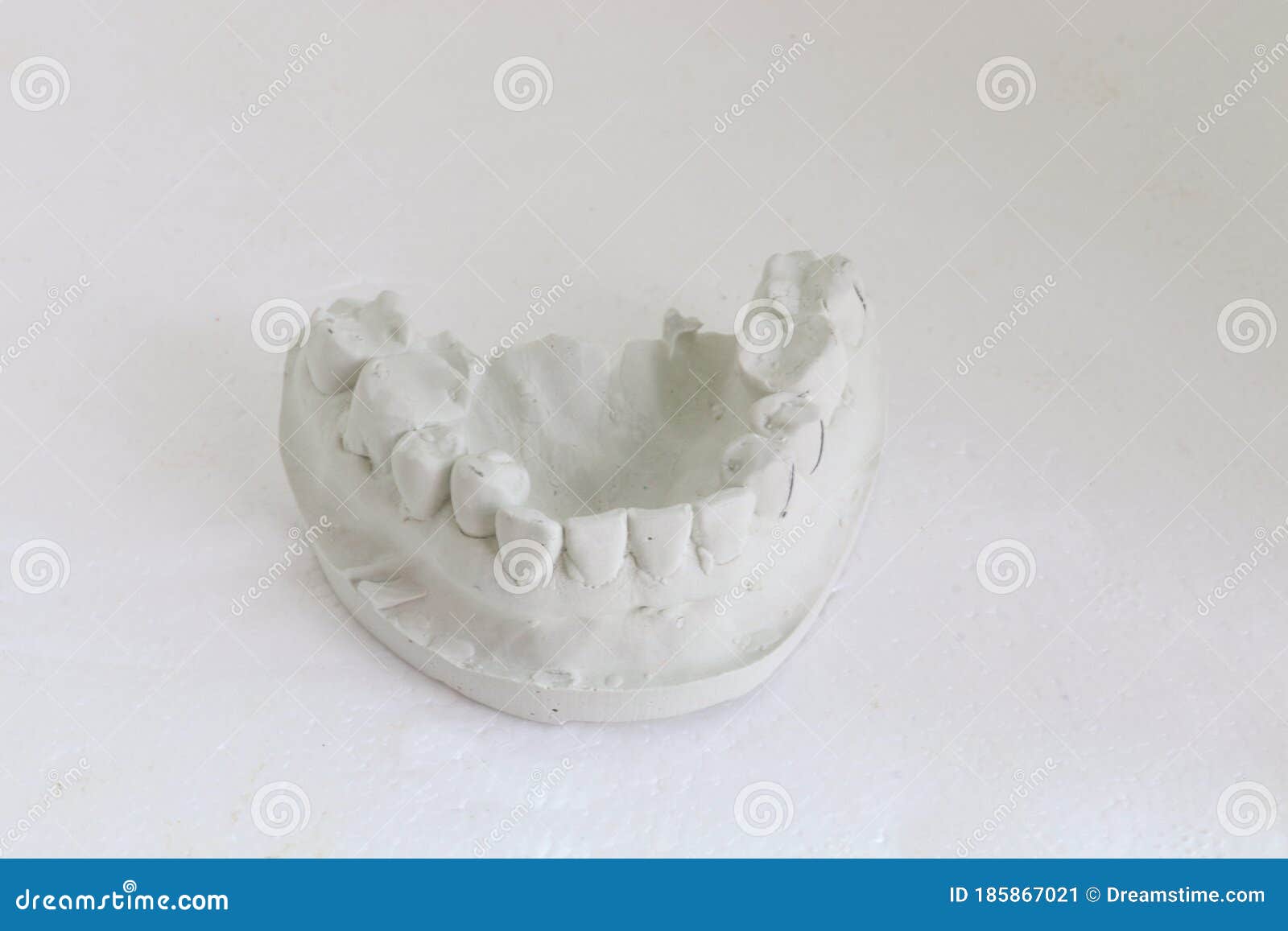 Plaster Impression Of Teeth. Dental Plaster Mold. Dental Mold Showing Teeth On A Table Viewed