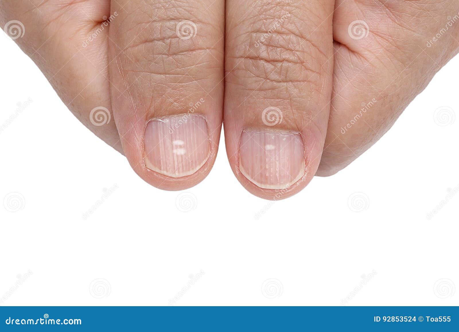 Check Your Fingernails! - Alessit Fit