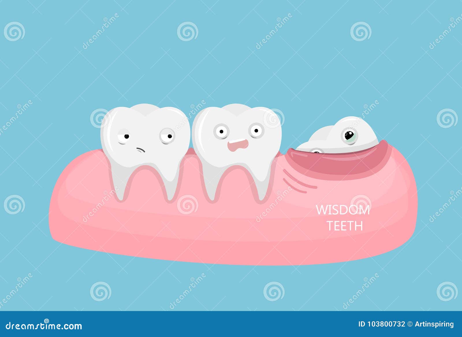 Wisdom teeth illustration. stock vector. Illustration of molar - 103800732 Wisdom teeth illustration. stock vector. Illustration of molar - 103800732