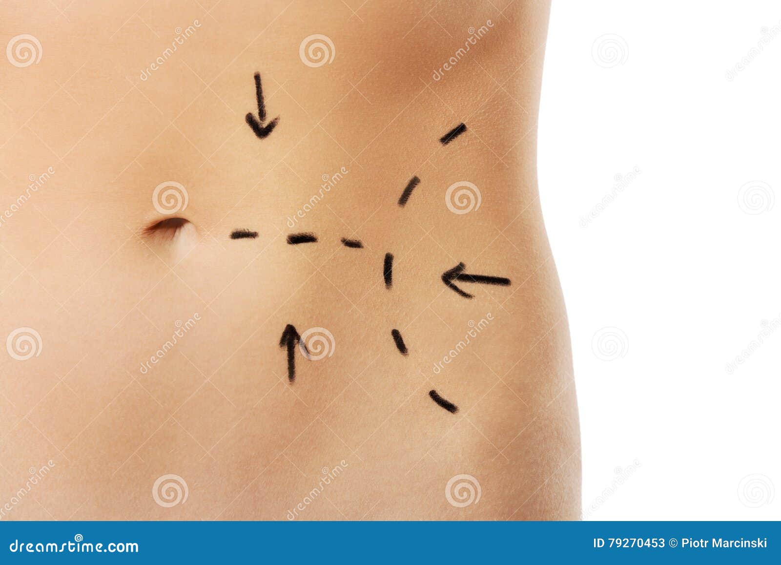 Woman body marked out for cosmetic surgery. Isolated on white.