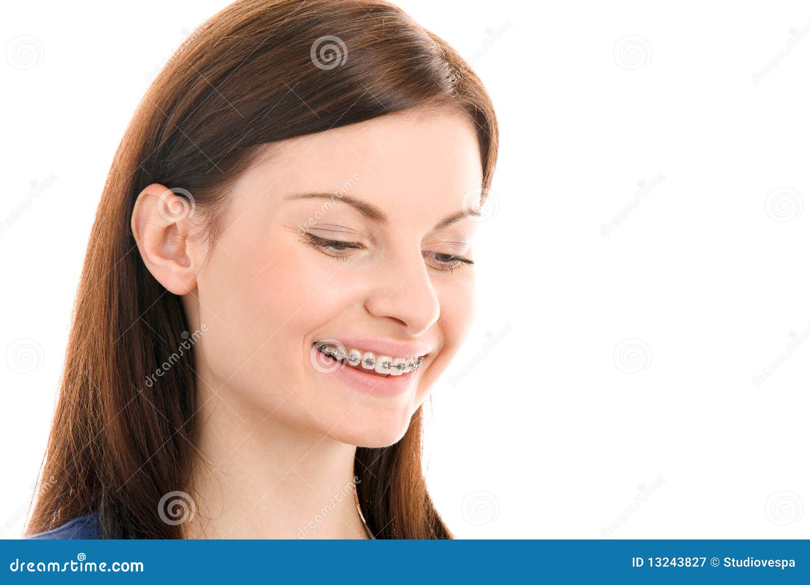 woman with brackets on teeth