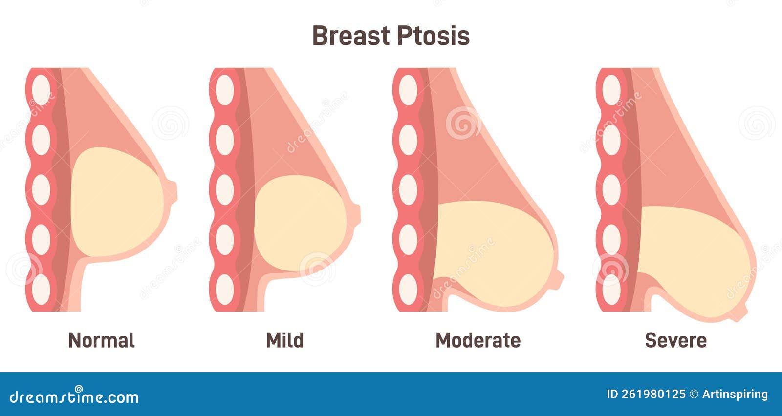 Diagram of Sagging Breasts and Womanâ€™s Body Illustration. Beauty