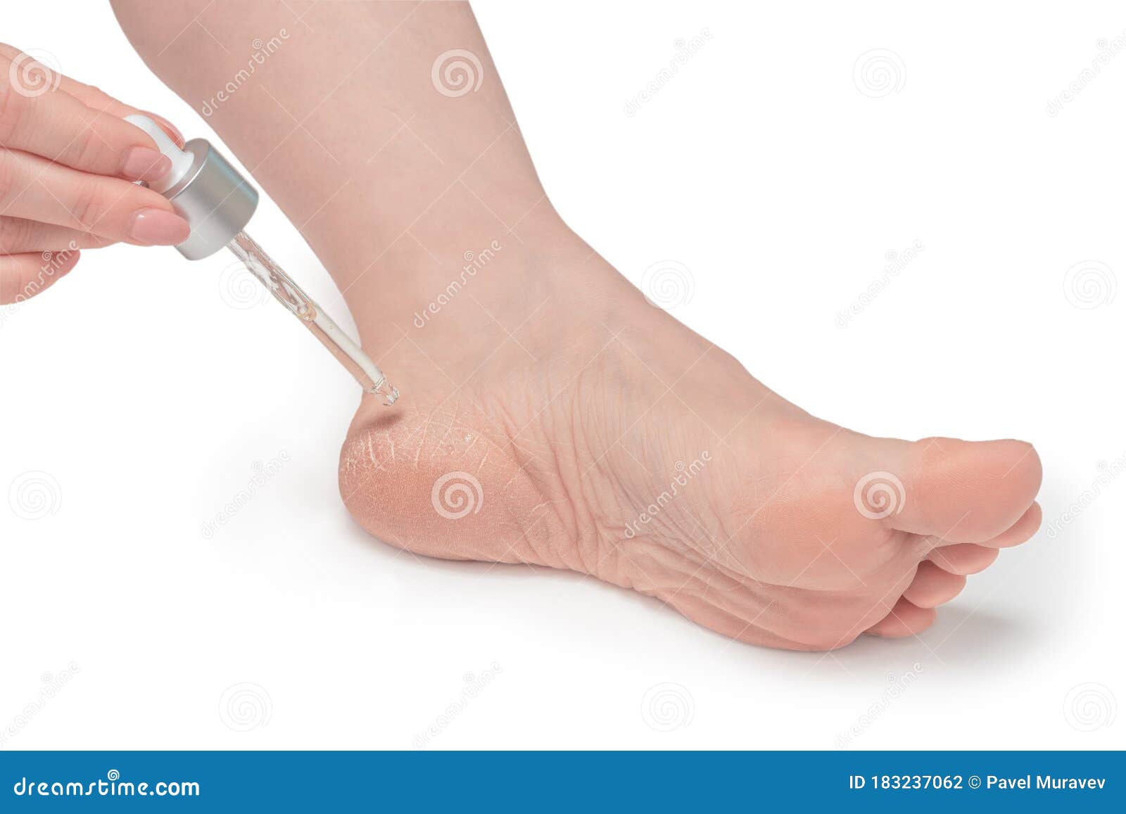 Feet with dry skin before and after treatment.... - Stock Photo [95796000]  - PIXTA