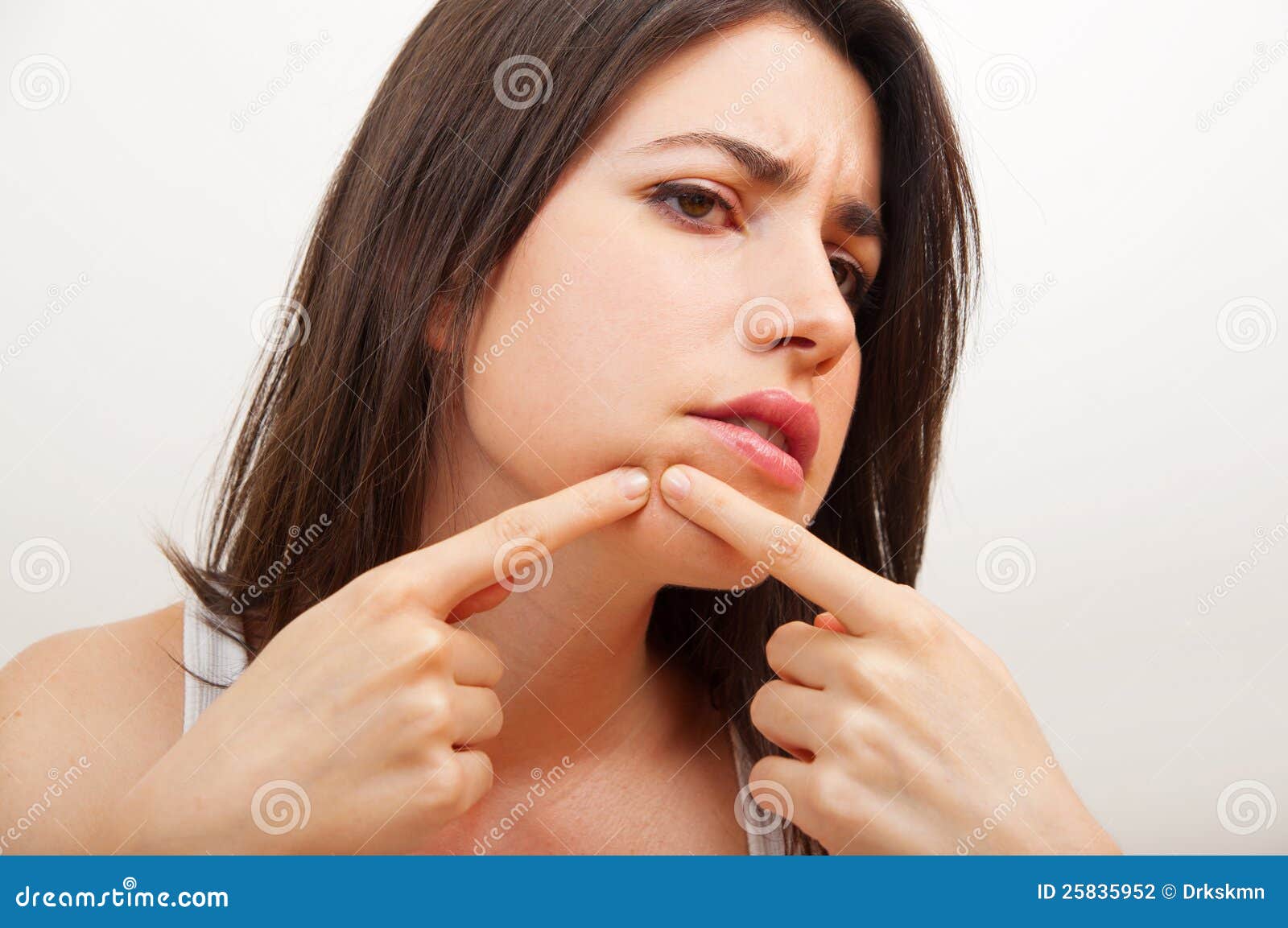 Woman Examining Herpes In Her Face Stock Photo Image of virus, care