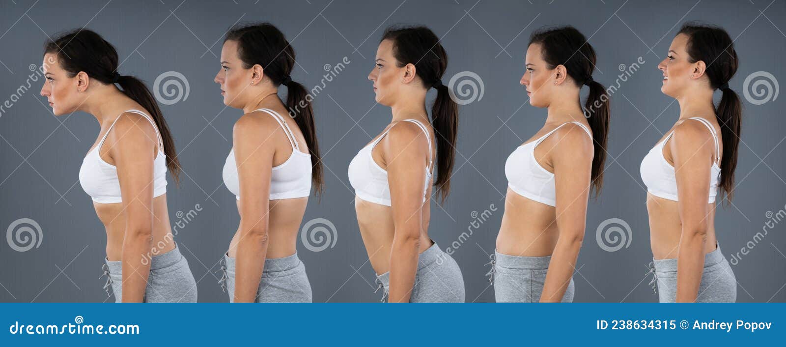 woman with lordosis, kyphosis, sway back and normal curvature
