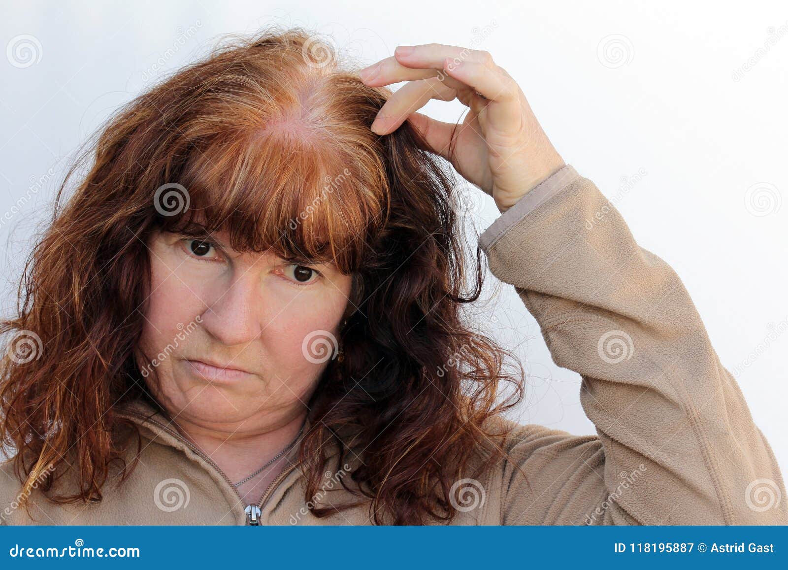 A Woman Has Problems with Hair Loss and a Sensitive Scalp Stock Image -  Image of help, hair: 118195887