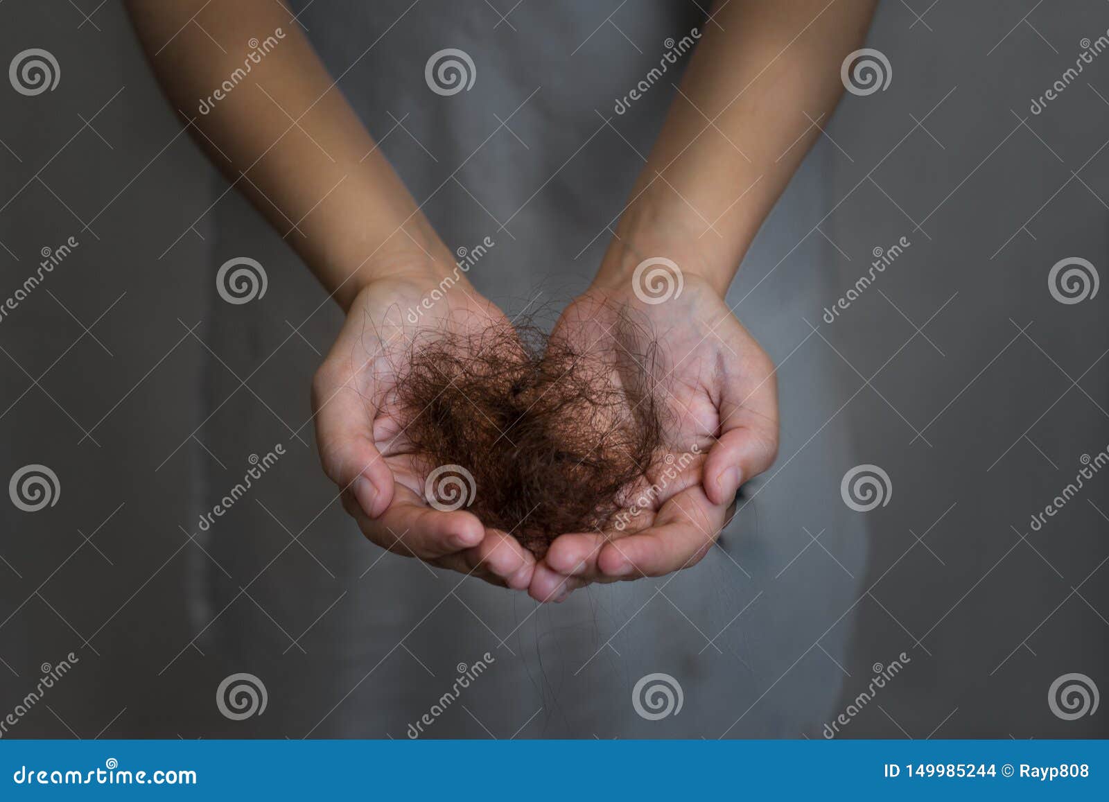 a woman suffering from hair loss. balding