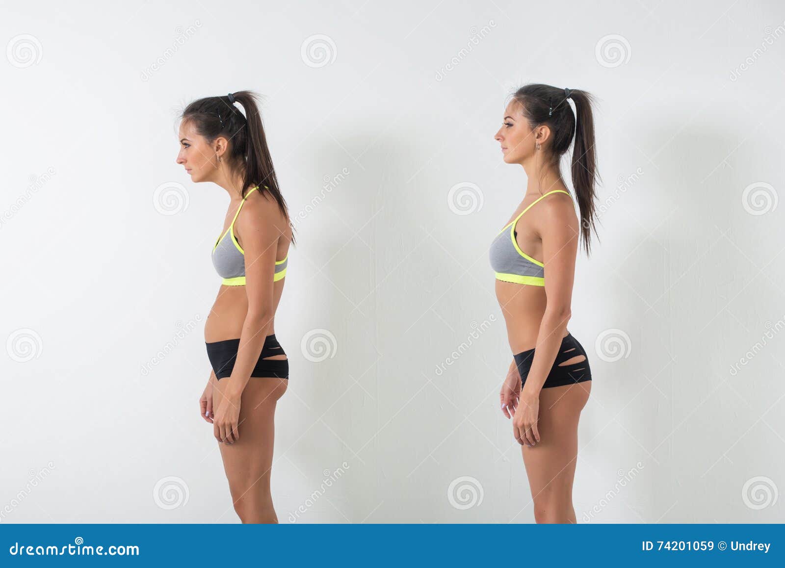 woman with impaired posture position defect scoliosis and ideal bearing