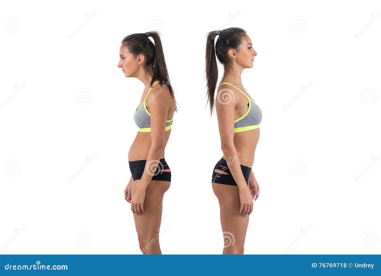 woman with impaired posture position defect scoliosis and ideal bearing