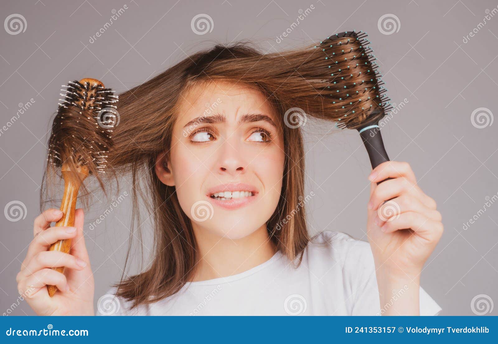 Woman Loosing Hair. Hair Loss Problem, Baldness. Stock Image Image of balding, care 241353157