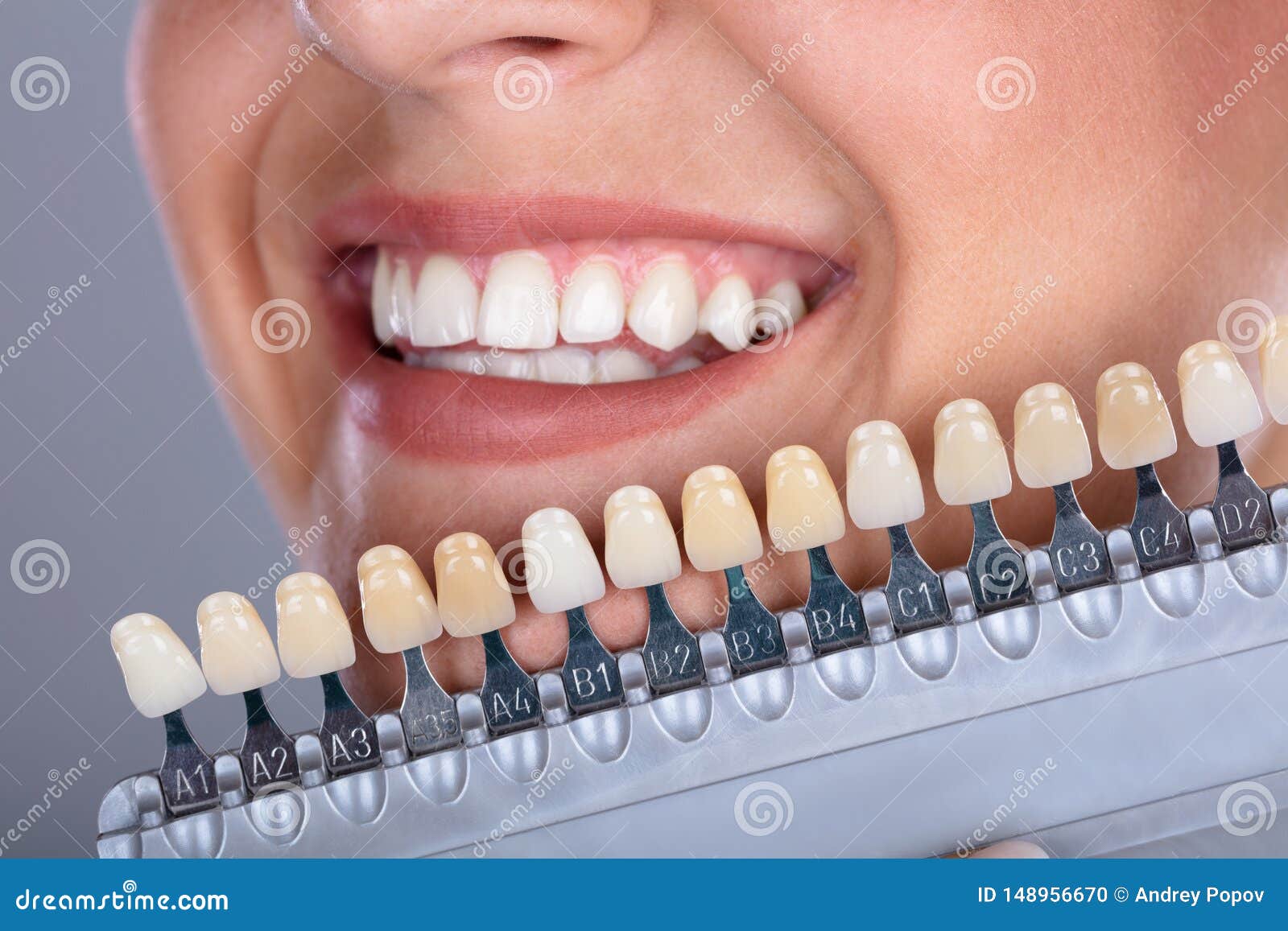 woman matching shade of the implant teeth