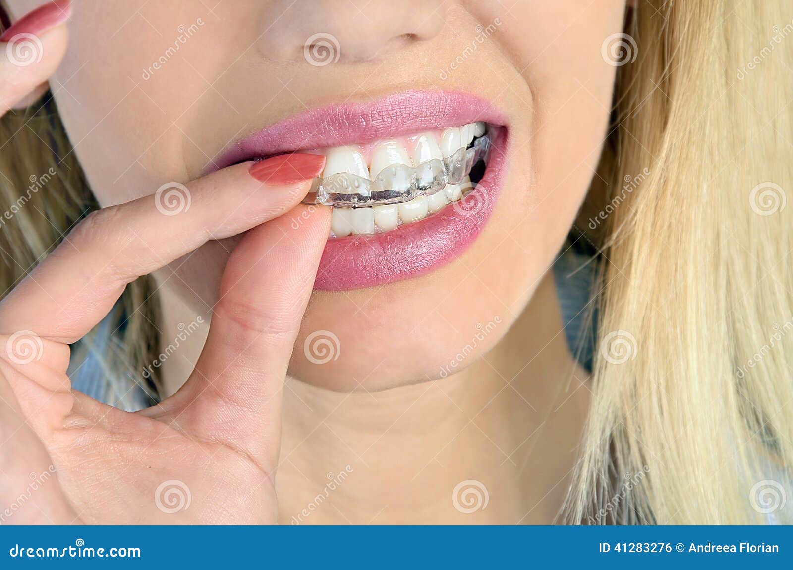 woman with mouthguard