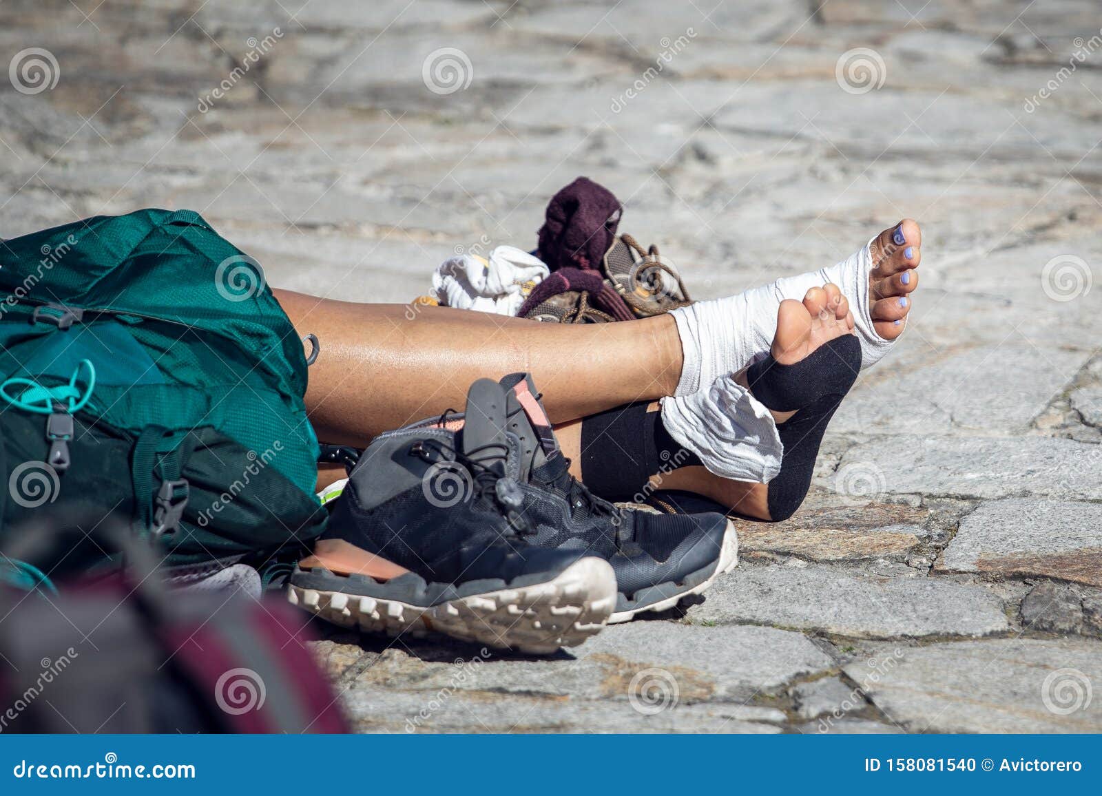 woman pilgrim legs with injured feet resting on obradoiro square, santiago de compostela, spain