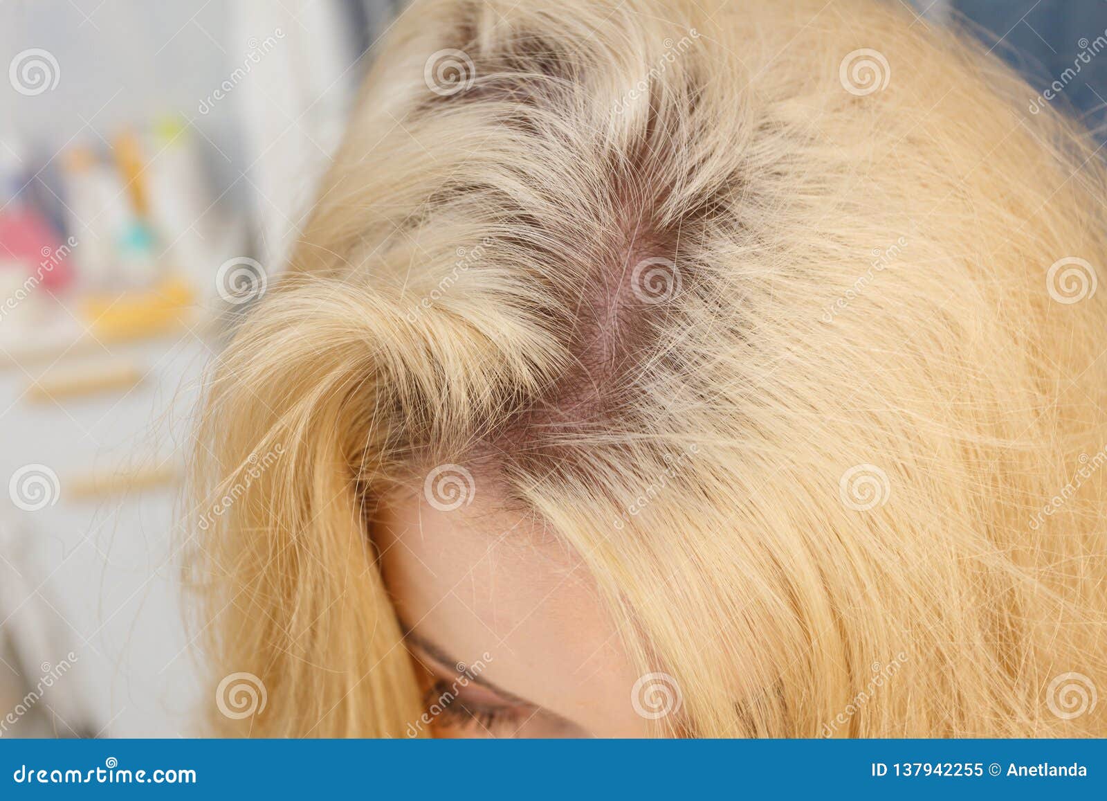 short blonde hair roots