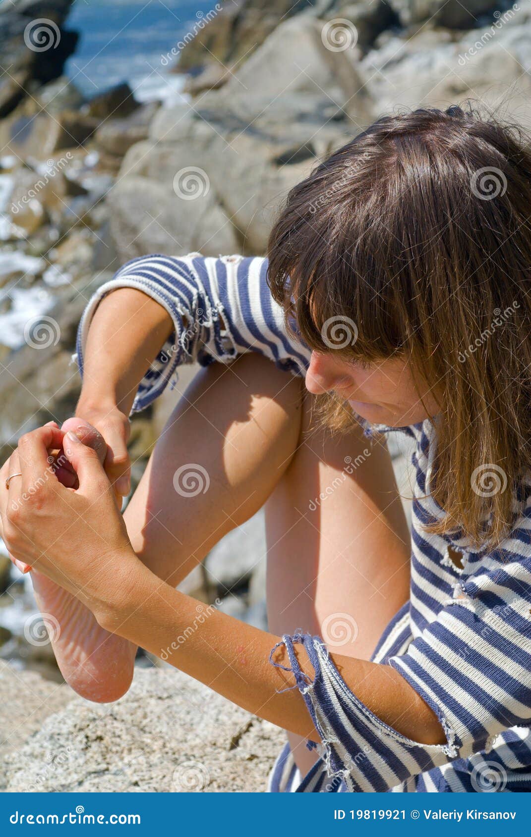 woman with splinter in foot 1