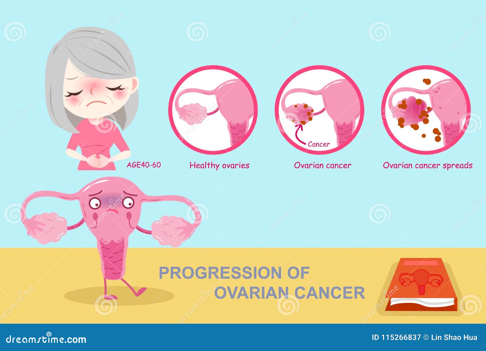 Woman Uterine Fibroids Diagram On White Background Cartoon Vector ...