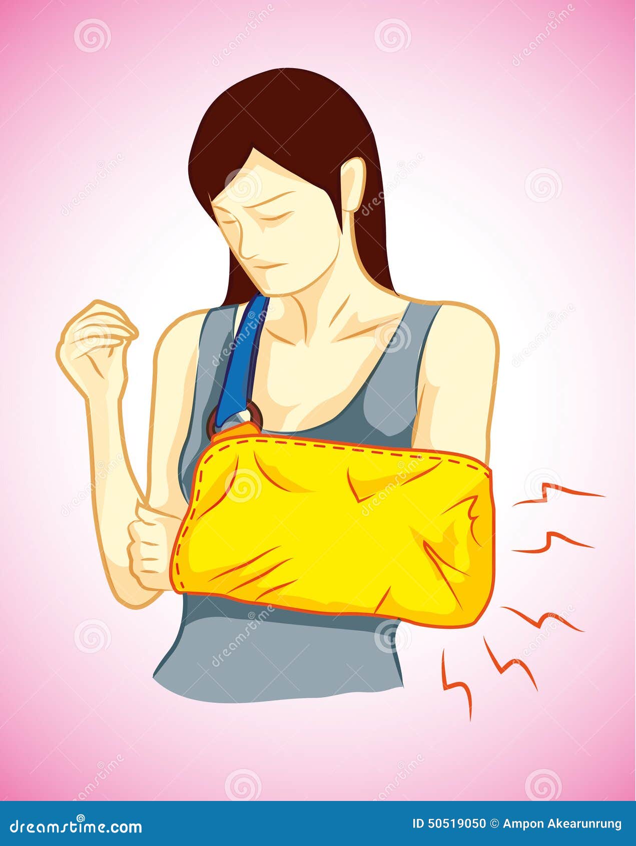 Woman was broken arm stock vector. Illustration of persons 50519050
