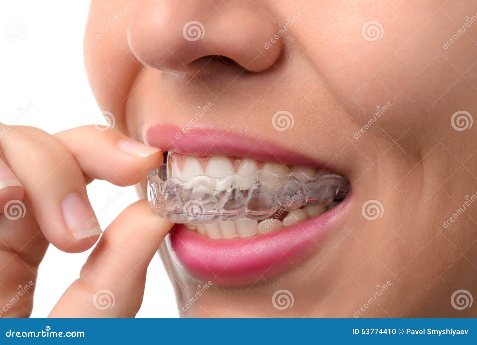 woman wearing orthodontic silicone trainer