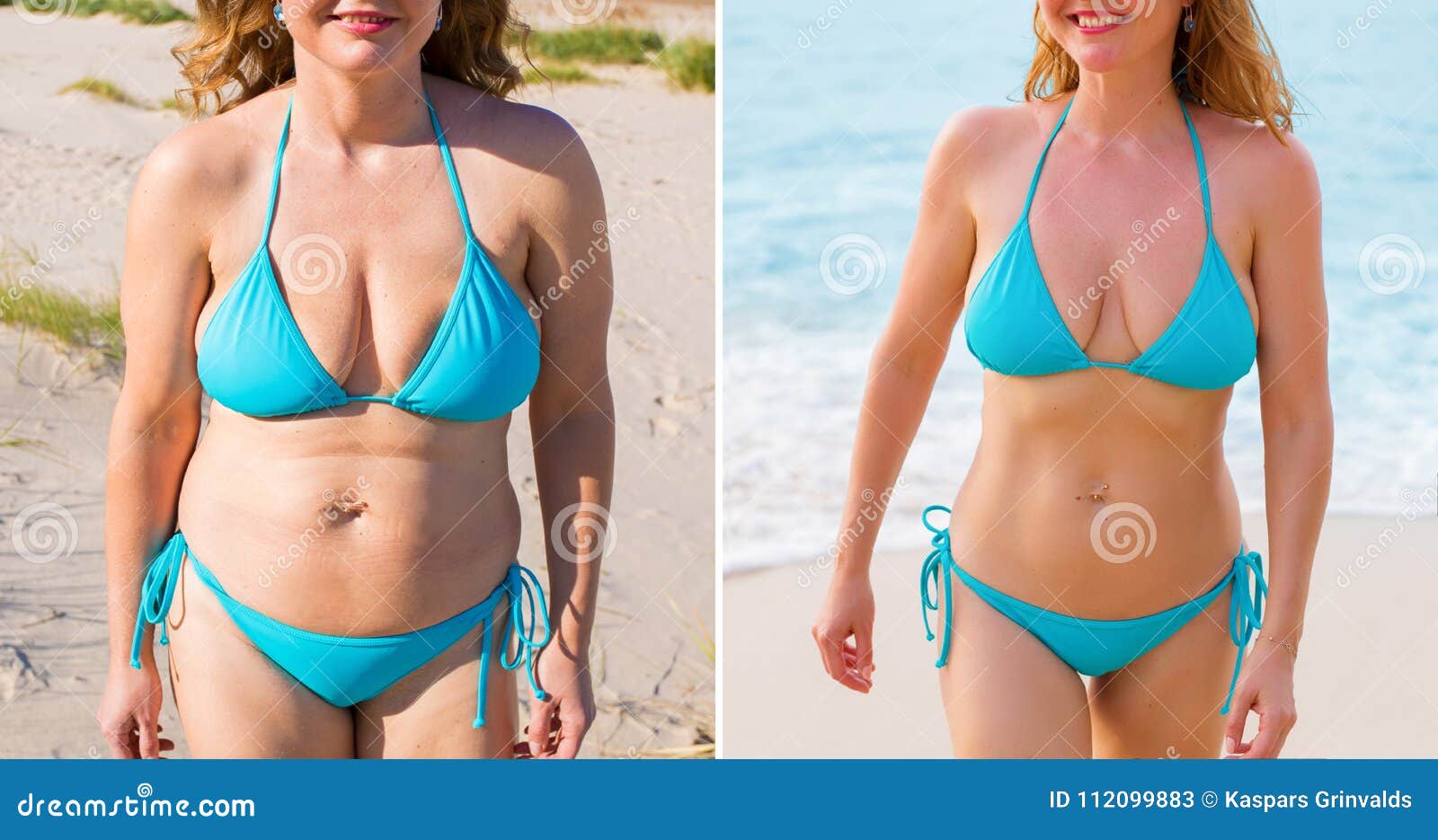 vragenlijst Comorama Mededogen Woman before and after Weight Loss Success Stock Image - Image of fitness,  losing: 112099883