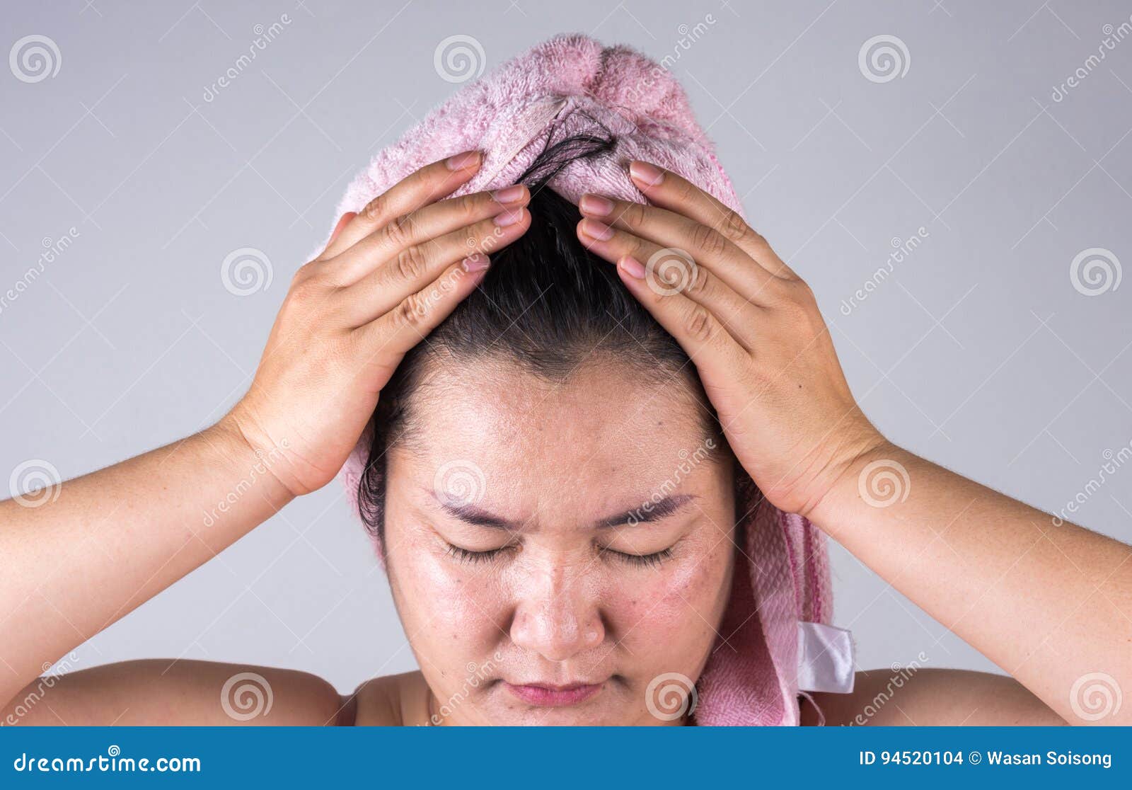 Women with Hair Loss Problems are Showing Some Hair Problems on Stock