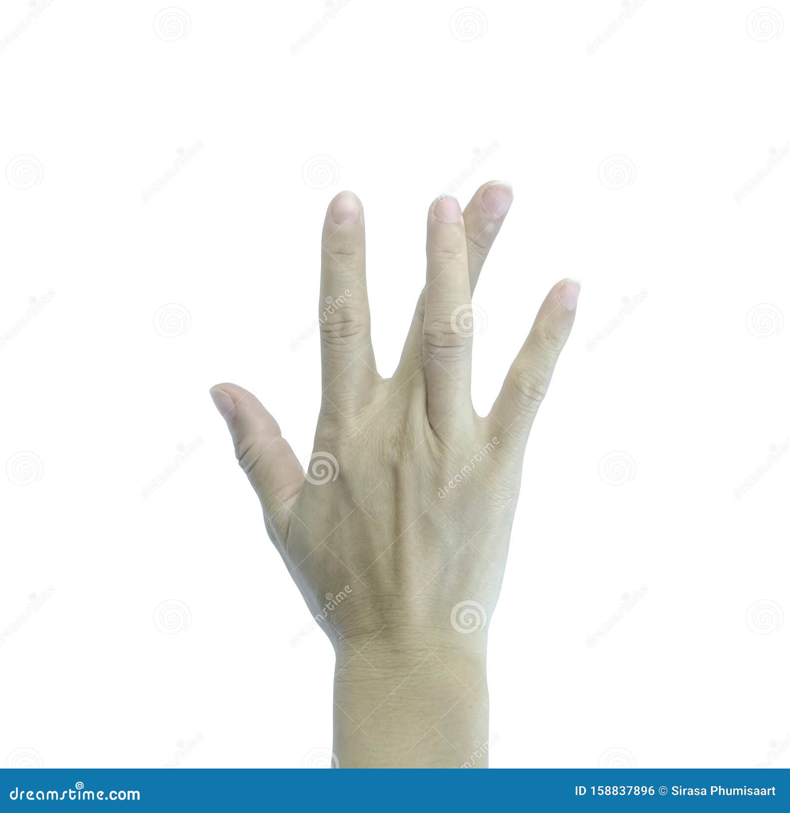Congenital Hand Differences | Johns Hopkins Medicine