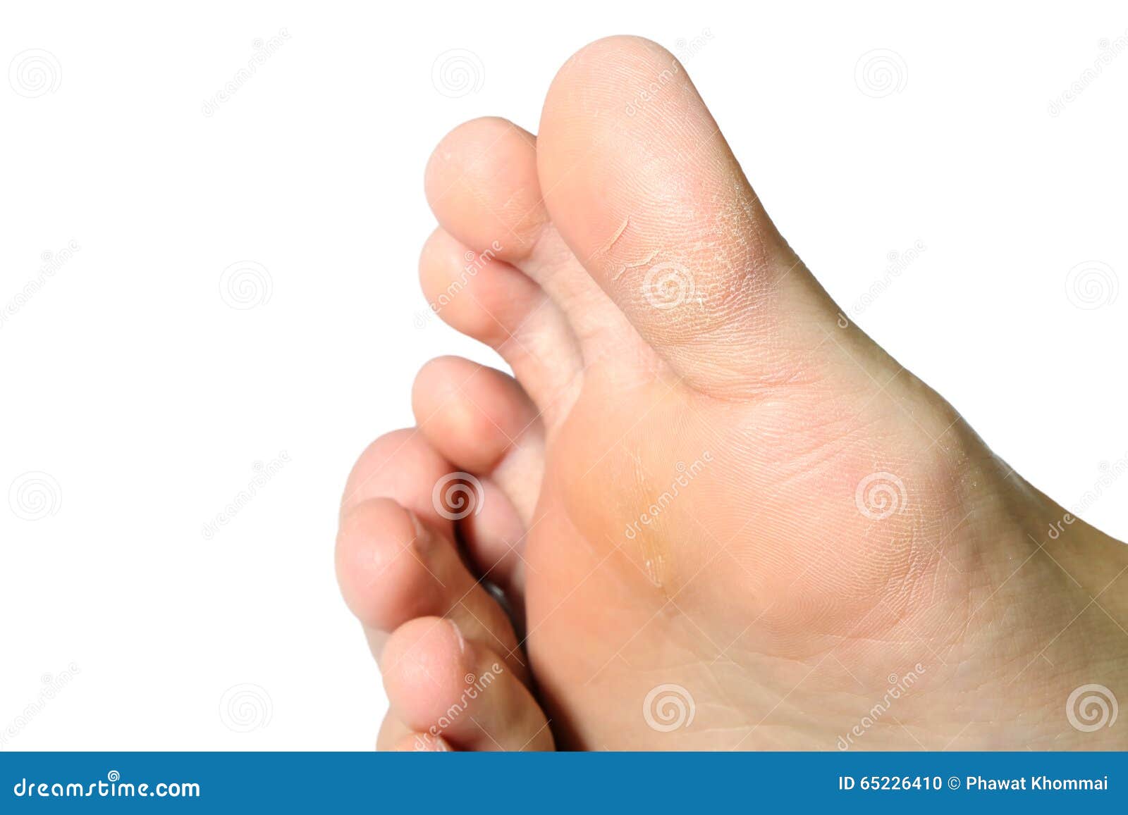 Women s feet dry stock photo. Image of women, closeup 65226410