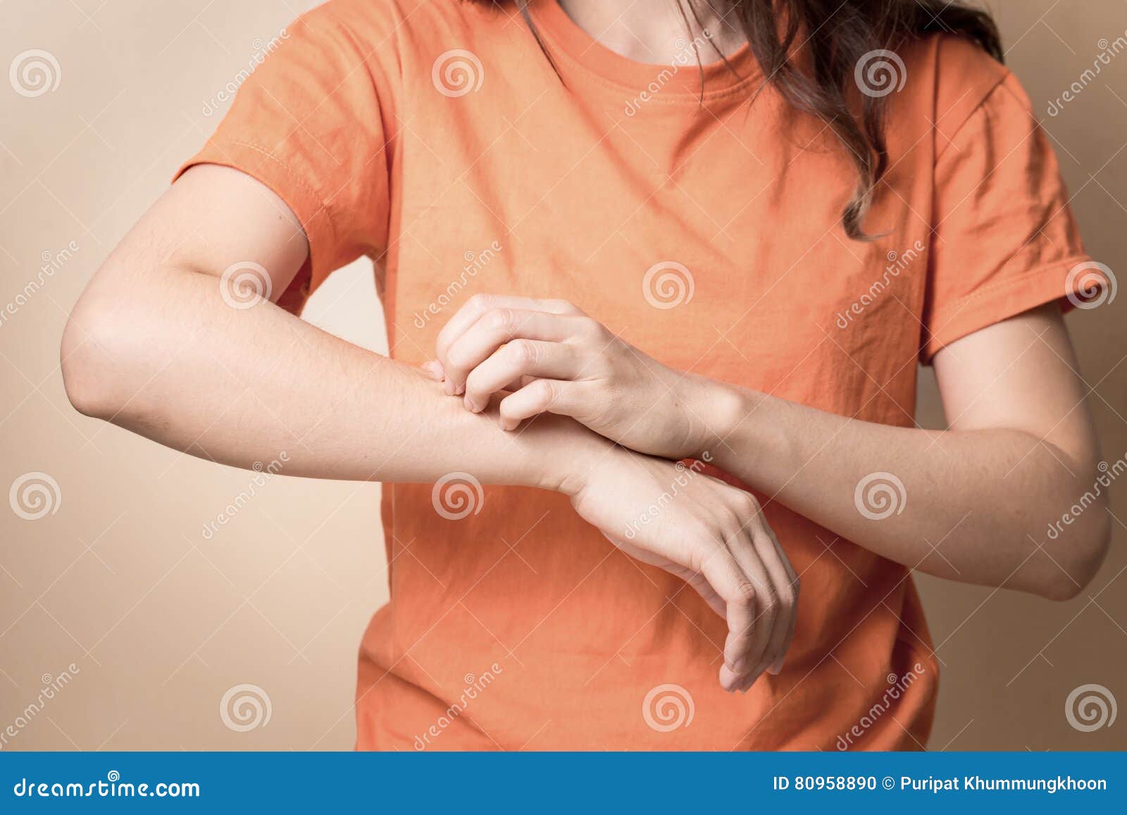 Women Scratch Itchy Arm, Women Scratch Itchy Arm with Hand. Stock Photo