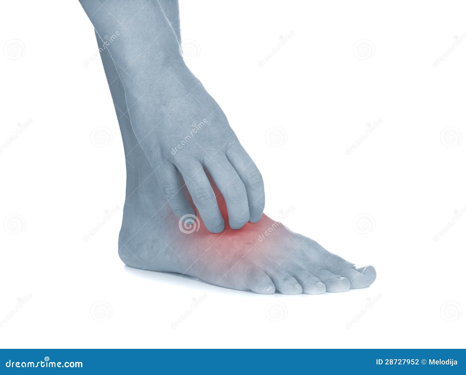 Women Scratch Itchy Leg With Hand. Stock Photography - Image: 28727952