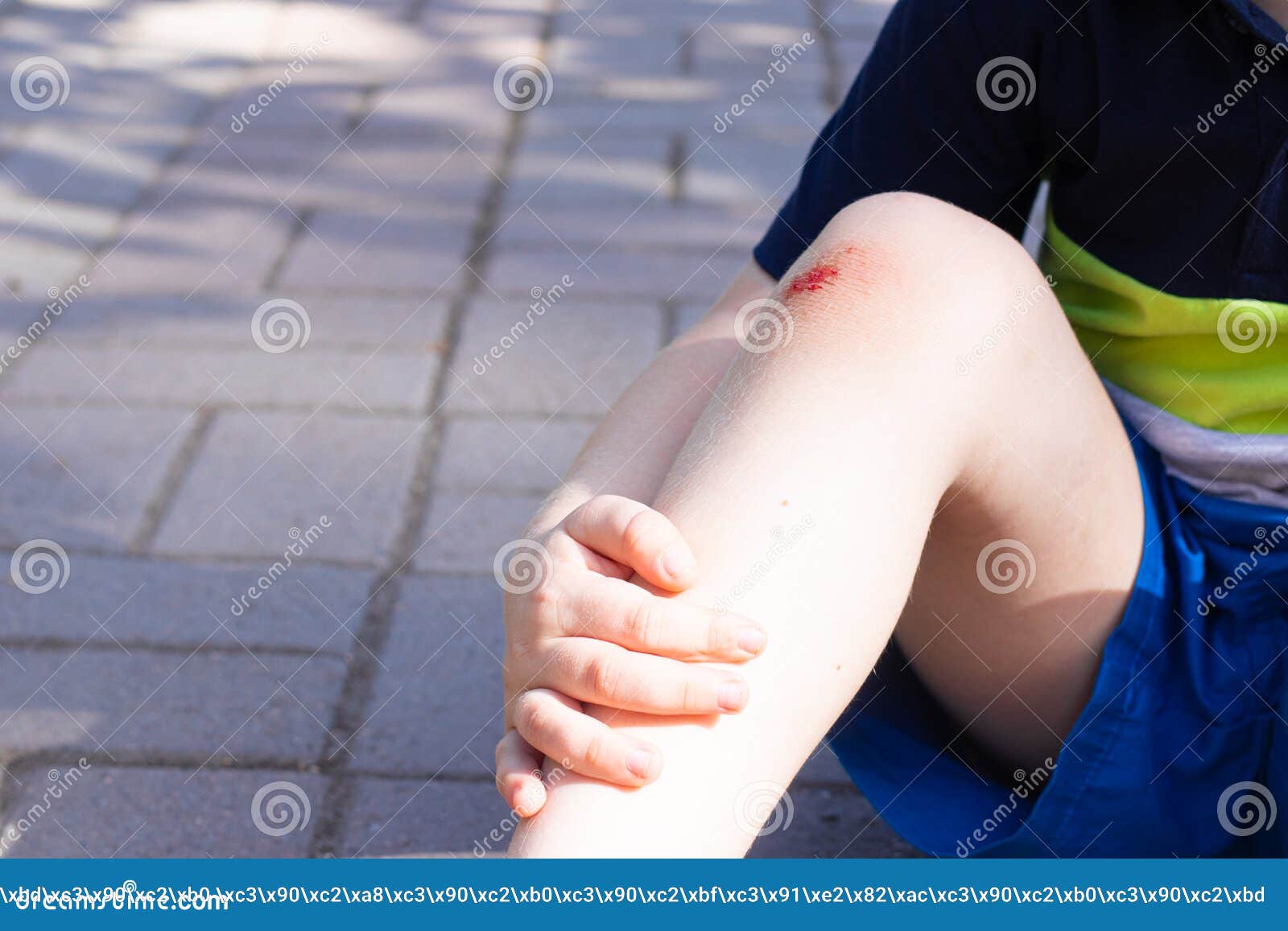 The Wound On The Child`s Leg Fell On The Road Broken Knee Health