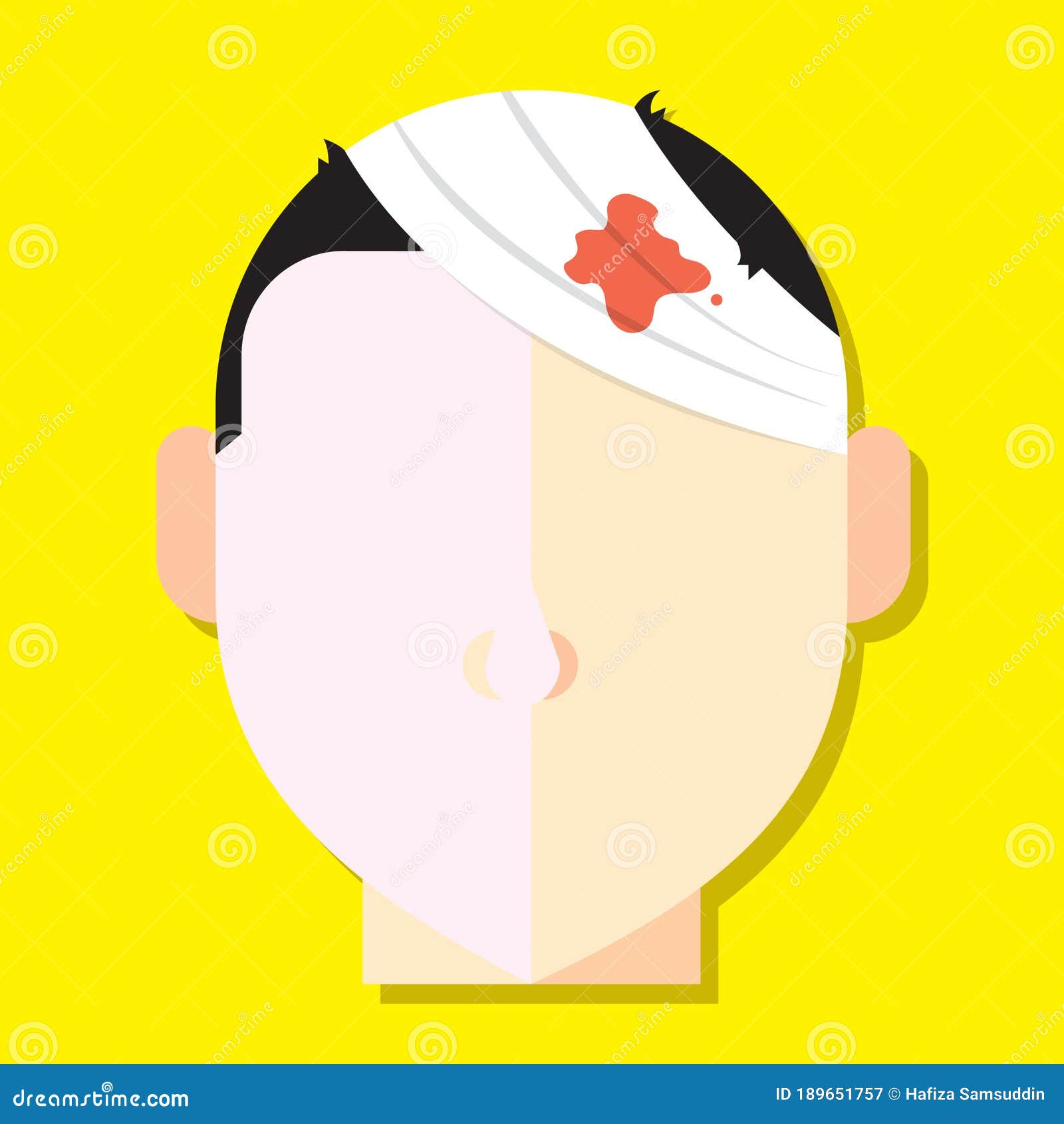 Wound on Head. Vector Illustration Decorative Design Stock Vector Illustration of medical