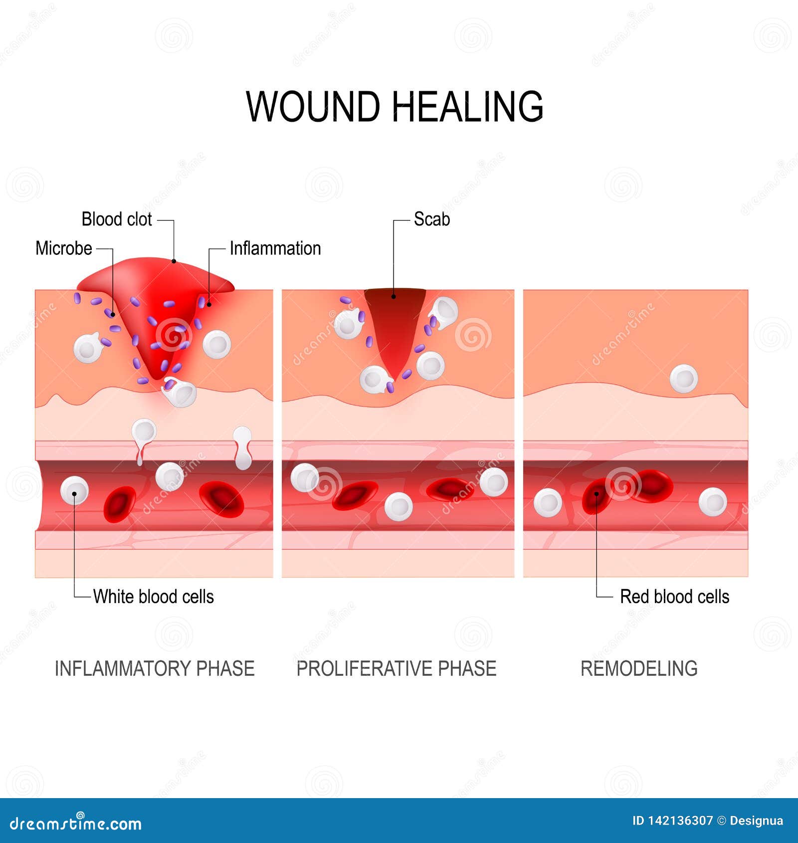 Wound Cartoons, Illustrations & Vector Stock Images - 15759 Pictures to