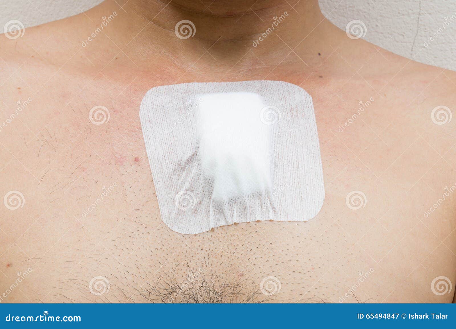 Wound from Surgery at the Chest Stock Image Image of adhesive